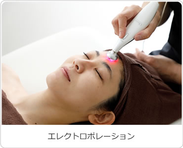 エレクトロポレーション